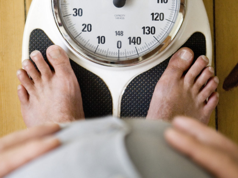 Obesity and Overweight